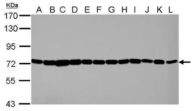 Anti-Hsp70 antibody used in Western Blot (WB). GTX111088
